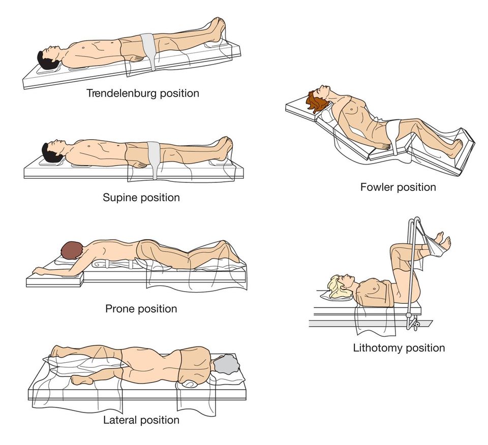 Supine patient positioning and portal designation. (A) Supine position