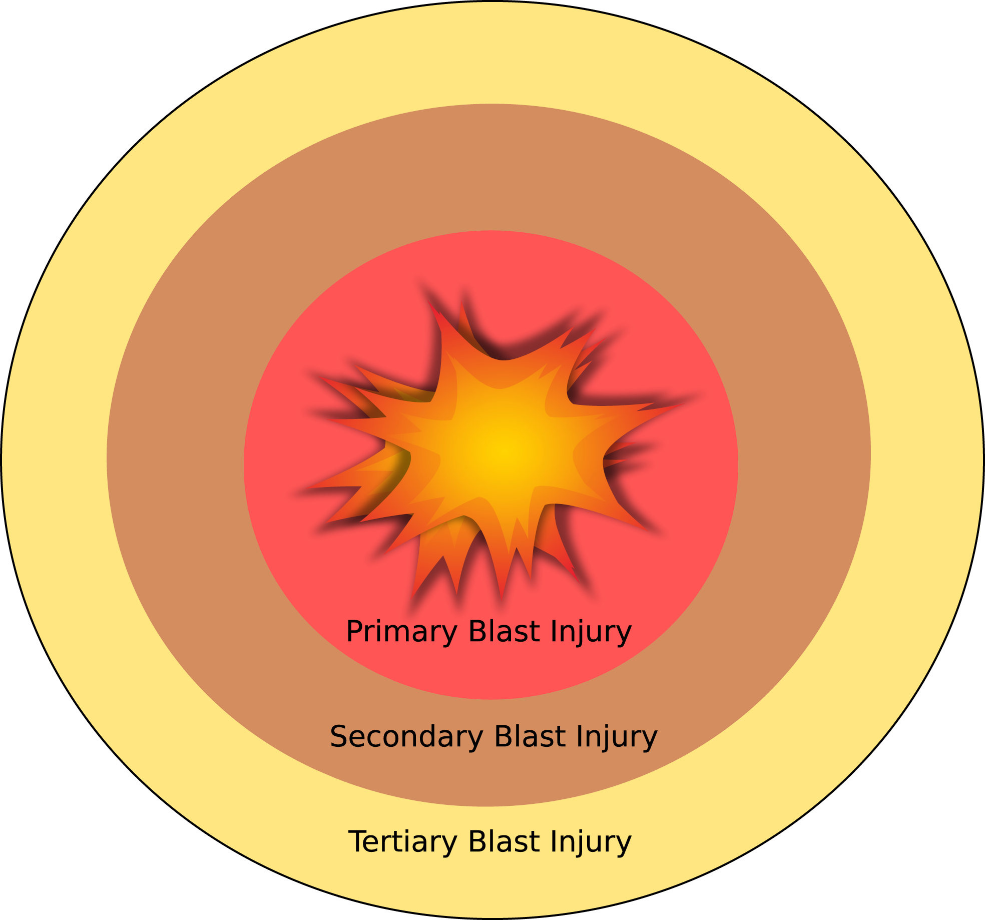 Blast Injuries Georgiaemsacademy