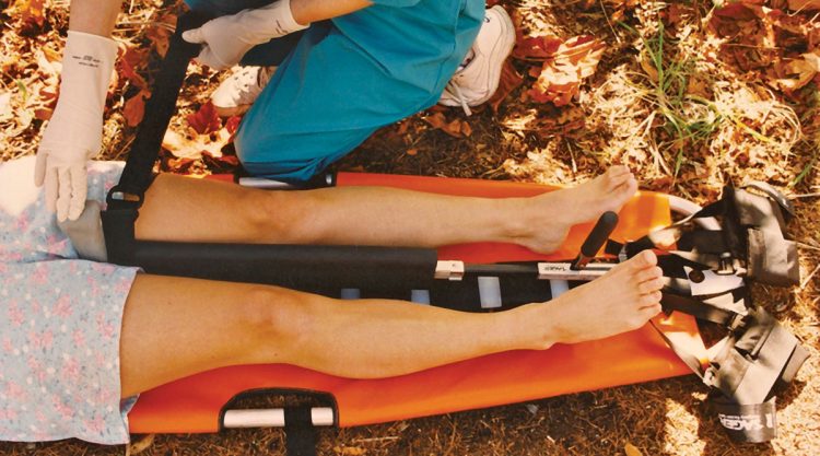 Traction Splint Examples Traction Splinting – georgiaemsacademy.com